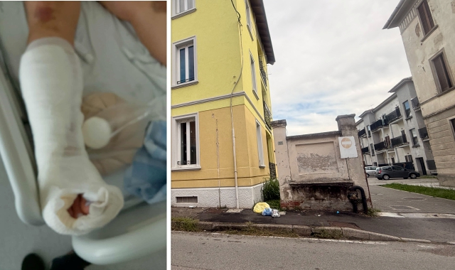 Agguato in garage a Busto: «Mi hanno massacrata»